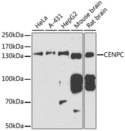 Invitrogen CENPC Polyclonal Antibody 100 &mu;L; Unconjugated:Antibodies,