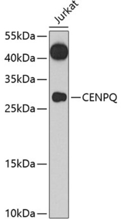 Invitrogen CENPQ Polyclonal Antibody 100 &mu;L; Unconjugated:Antibodies,