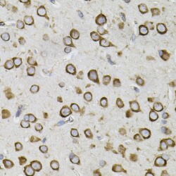Invitrogen CEP164 Polyclonal Antibody 100 μL; Unconjugated:Antibodies,