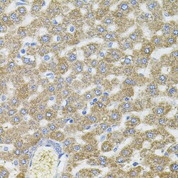 Invitrogen CEP164 Polyclonal Antibody 100 μL; Unconjugated:Antibodies,