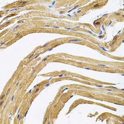 Invitrogen CEP164 Polyclonal Antibody 100 μL; Unconjugated:Antibodies,