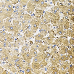 Invitrogen CEP164 Polyclonal Antibody 100 μL; Unconjugated:Antibodies,