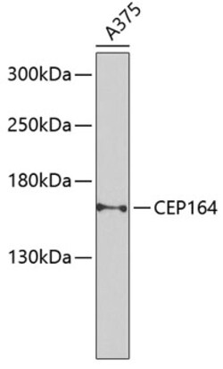Invitrogen CEP164 Polyclonal Antibody 100 μL; Unconjugated:Antibodies,