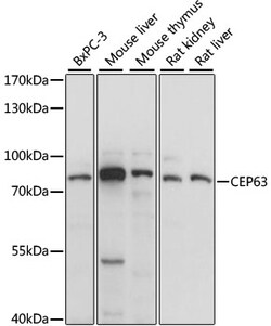 Invitrogen CEP63 Polyclonal Antibody 100 &mu;L; Unconjugated:Antibodies,