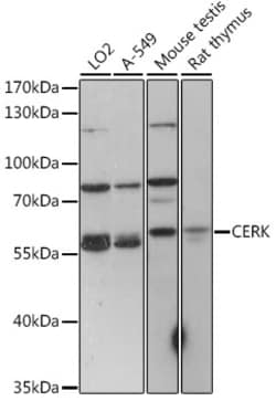 Invitrogen CERK Polyclonal Antibody 100 &mu;L; Unconjugated:Antibodies,