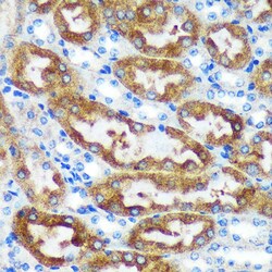Invitrogen CHCHD2 Polyclonal Antibody 100 &mu;L | Buy Online | Invitrogen&trade; | Fisher Scientific