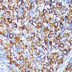 Invitrogen CHCHD2 Polyclonal Antibody 100 &mu;L | Buy Online | Invitrogen&trade; | Fisher Scientific