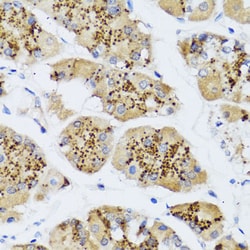 Invitrogen CHIC2 Polyclonal Antibody 100 &mu;L; Unconjugated:Antibodies,
