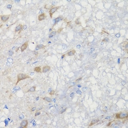 Invitrogen CHIC2 Polyclonal Antibody 100 &mu;L; Unconjugated:Antibodies,