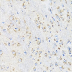 Invitrogen CHIC2 Polyclonal Antibody 100 &mu;L; Unconjugated:Antibodies,