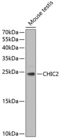 Invitrogen CHIC2 Polyclonal Antibody 100 &mu;L; Unconjugated:Antibodies,