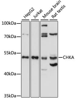 Invitrogen CHKA Polyclonal Antibody 100 &mu;L; Unconjugated:Antibodies,