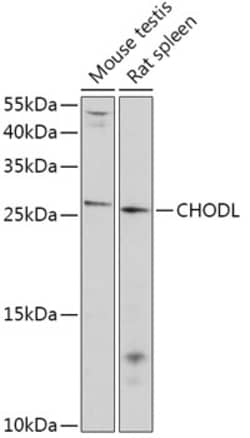 Invitrogen Chondrolectin Polyclonal Antibody 100 &mu;L; Unconjugated:Antibodies,