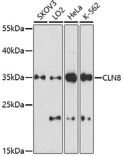 Invitrogen CLN8 Polyclonal Antibody 100 &mu;L; Unconjugated:Antibodies,