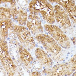 Invitrogen CLNS1A Polyclonal Antibody 100 &mu;L; Unconjugated:Antibodies,