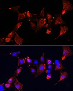 Invitrogen CLUH Polyclonal Antibody 100 &mu;L; Unconjugated:Antibodies,