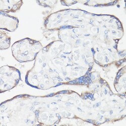 Invitrogen CLUH Polyclonal Antibody 100 &mu;L; Unconjugated:Antibodies,