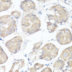 Invitrogen CLUH Polyclonal Antibody 100 &mu;L; Unconjugated:Antibodies,