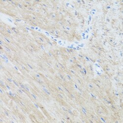 Invitrogen CLUH Polyclonal Antibody 100 &mu;L; Unconjugated:Antibodies,