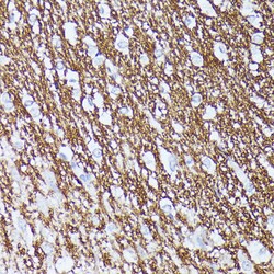 Invitrogen CNTN1 Polyclonal Antibody 100 &mu;L; Unconjugated:Antibodies,