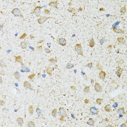 Invitrogen COG2 Polyclonal Antibody 100 μL; Unconjugated:Antibodies,