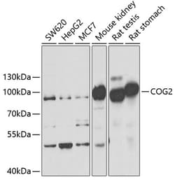 Invitrogen COG2 Polyclonal Antibody 100 μL; Unconjugated:Antibodies,