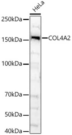 Invitrogen COL4A2 Polyclonal Antibody 100 &mu;L | Buy Online | Invitrogen&trade; | Fisher Scientific
