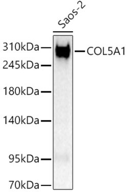 Invitrogen COL5A1 Polyclonal Antibody 100 &mu;L; Unconjugated:Antibodies,