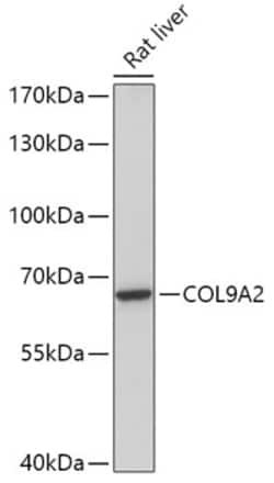 Invitrogen COL9A2 Polyclonal Antibody 100 &mu;L; Unconjugated:Antibodies,
