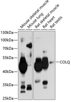 Invitrogen COLQ Polyclonal Antibody 100 &mu;L; Unconjugated:Antibodies,