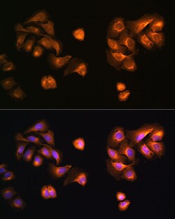 Invitrogen COPZ1 Polyclonal Antibody 100 &mu;L; Unconjugated:Antibodies,