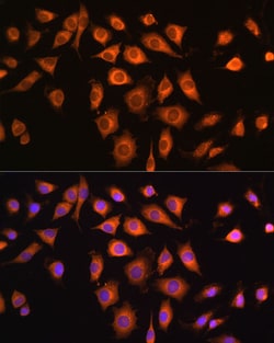 Invitrogen COPZ1 Polyclonal Antibody 100 &mu;L; Unconjugated:Antibodies,