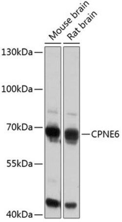 Invitrogen CPNE6 Polyclonal Antibody 100 μL; Unconjugated:Antibodies,