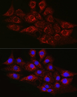 Invitrogen CPT2 Polyclonal Antibody 100 &mu;L; Unconjugated:Antibodies,