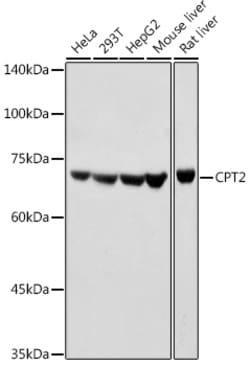 Invitrogen CPT2 Polyclonal Antibody 100 &mu;L; Unconjugated:Antibodies,