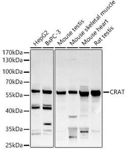 Invitrogen CAT1 Polyclonal Antibody 100 &mu;L; Unconjugated:Antibodies,