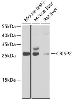 Invitrogen CRISP2 Polyclonal Antibody 100 &mu;L; Unconjugated:Antibodies,