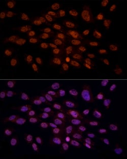 Invitrogen CRYGC Polyclonal Antibody 100 &mu;L; Unconjugated:Antibodies,