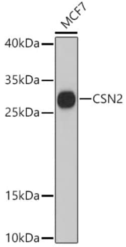 Invitrogen Beta-casein Polyclonal Antibody 100 &mu;L; Unconjugated:Antibodies,