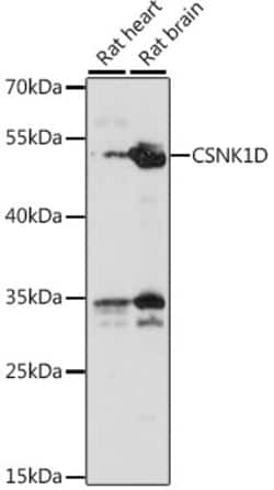 Invitrogen CK1 delta Polyclonal Antibody 100 μL; Unconjugated:Antibodies,