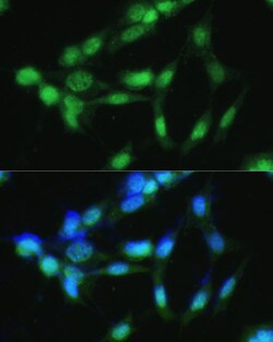 Invitrogen CSNK2A2 Polyclonal Antibody 100 μL; Unconjugated:Antibodies,
