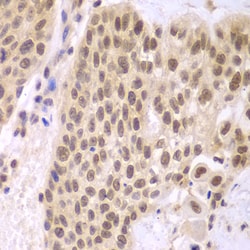 Invitrogen CSNK2A2 Polyclonal Antibody 100 μL; Unconjugated:Antibodies,