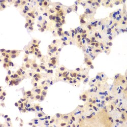 Invitrogen CSNK2A2 Polyclonal Antibody 100 μL; Unconjugated:Antibodies,