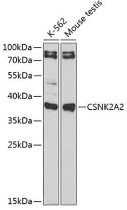 Invitrogen CSNK2A2 Polyclonal Antibody 100 μL; Unconjugated:Antibodies,