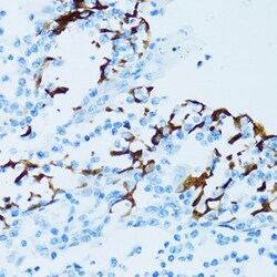 Invitrogen Cathepsin E Polyclonal Antibody 100 μL; Unconjugated:Antibodies,