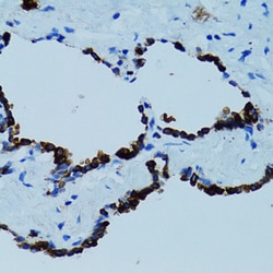 Invitrogen Cathepsin E Polyclonal Antibody 100 μL; Unconjugated:Antibodies,
