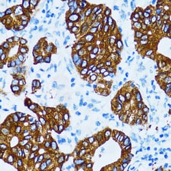 Invitrogen Cathepsin E Polyclonal Antibody 100 μL; Unconjugated:Antibodies,
