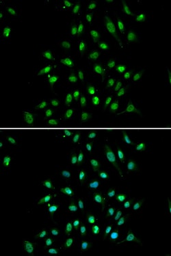 Invitrogen CGBP Polyclonal Antibody 100 μL; Unconjugated:Antibodies,