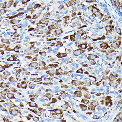 Invitrogen CYP11A1 Polyclonal Antibody 100 &mu;L; Unconjugated:Antibodies,