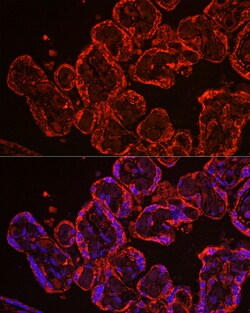 Invitrogen CYP11A1 Polyclonal Antibody 100 &mu;L; Unconjugated:Antibodies,